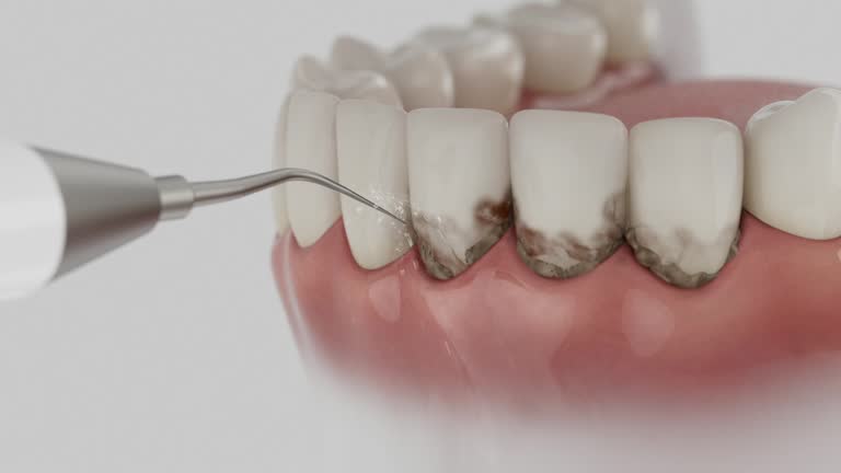 Reliable Dental Implants contractor in Madison, AL by Smile Center Dentistry